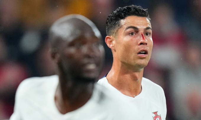 Ronaldo đổ máu ngày Bồ Đào Nha đại thắng CH Czech