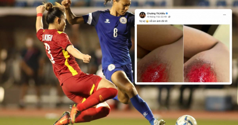 Ám ảnh ùa về, ngôi sao tuyển nữ Việt Nam đổ máu trong trận thua Philippines